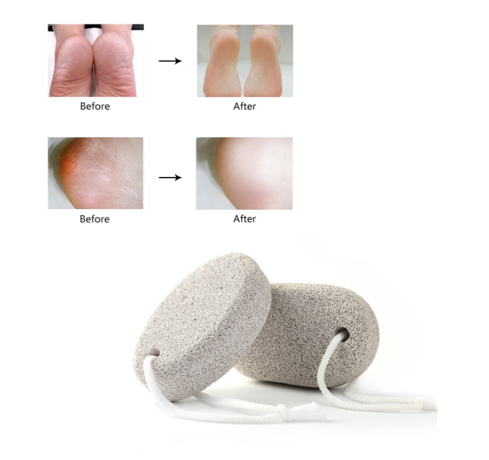 Volcanic Pumice Stone – Natural Foot Exfoliating Stone